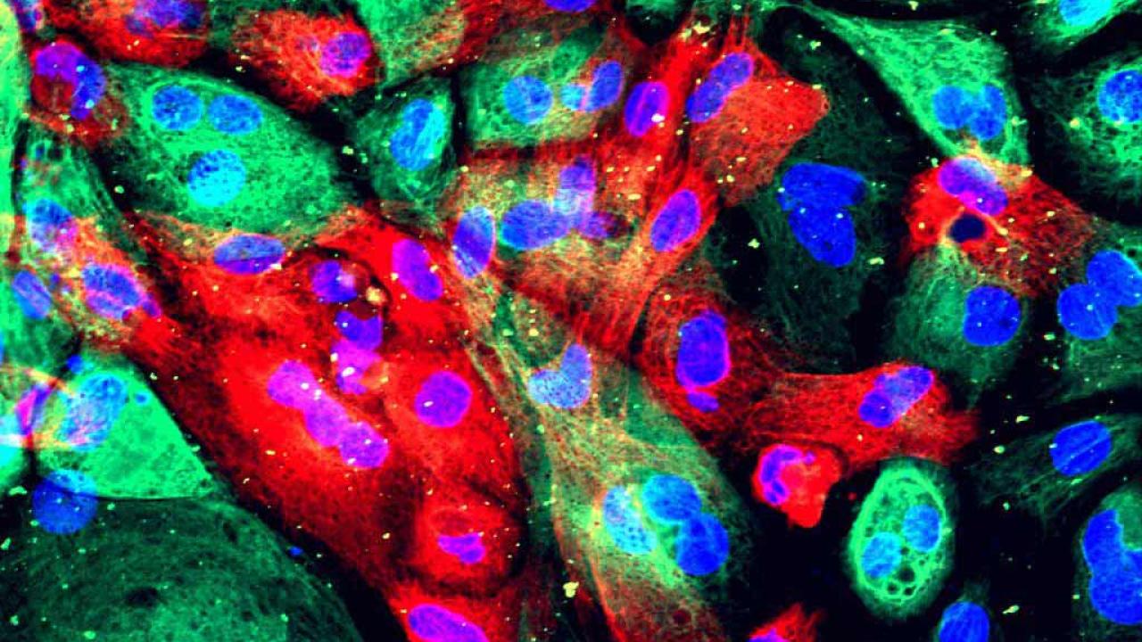 Human prostate cells from an organoid, an artificial construct that resembles an organ. Image by National Cancer Institute, NIH Human prostate cells from an organoid, an artificial construct that resembles an organ. Image by National Cancer Institute, NIH
